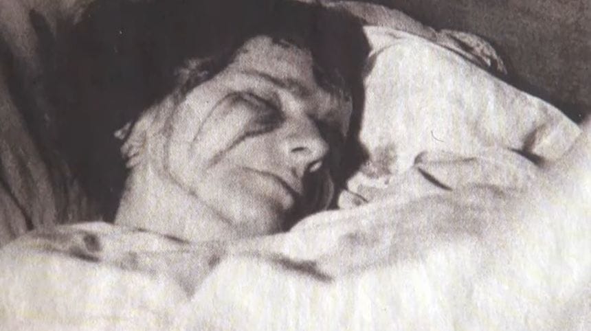 Illustration des stigmates mystiques liés à l’affaire Marthe Robin, thème exploré dans l’enquête de Sophie Vitali et Didier Santiago pour l’émission Kurious Anima, qui analyse les phénomènes spirituels et leurs interprétations.